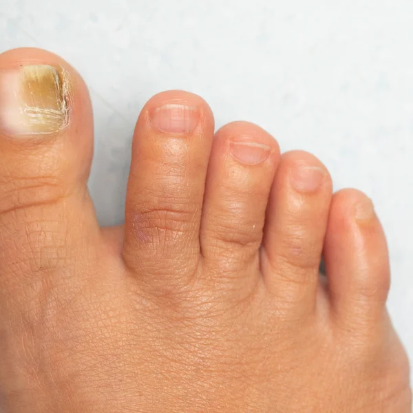 Causes principales et facteurs de risque