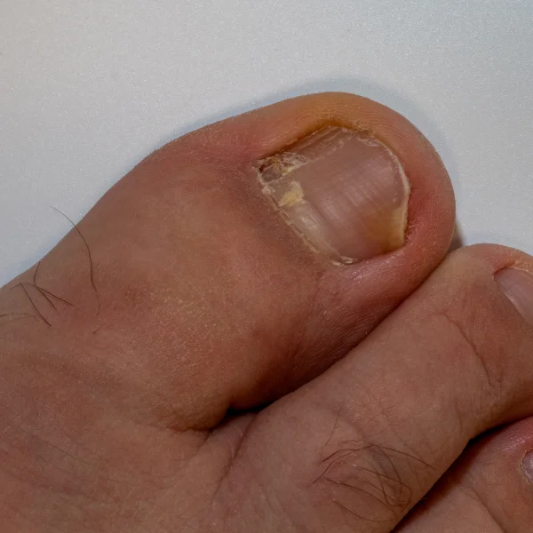 Modern Therapeutic Solutions