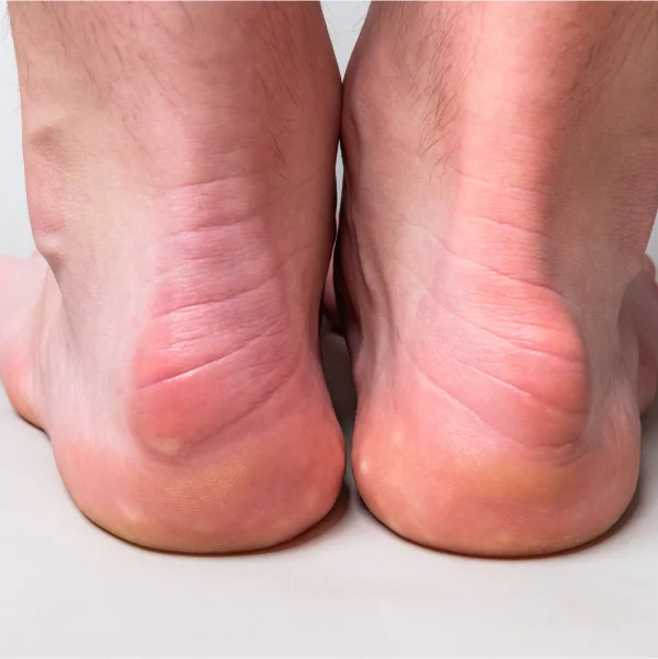 Solutions and Effective Treatments