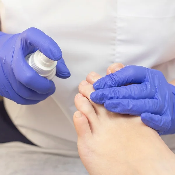 Une personne portant des gants bleus applique une crème pour les pieds sur un pied.